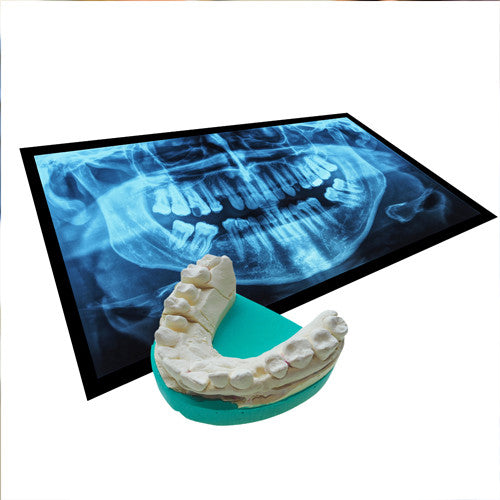 Dental impression taking